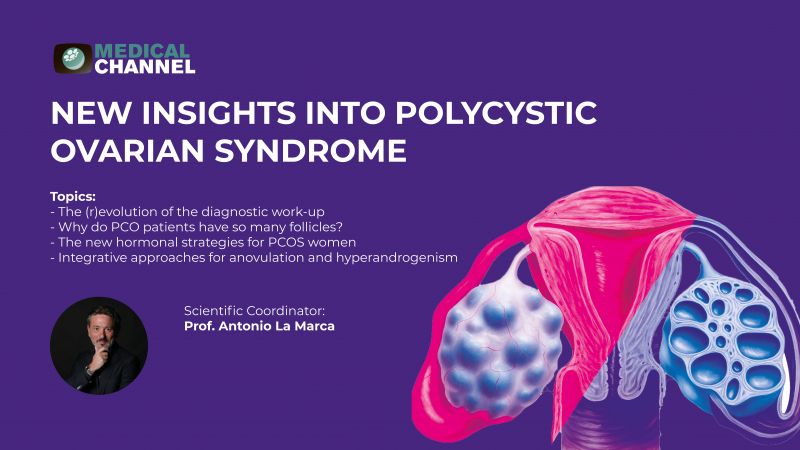 New insights into Polycystic Ovarian Syndrome