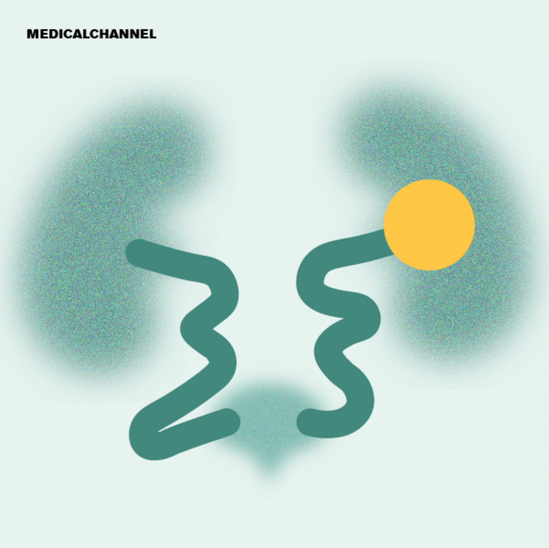 Advances in Nephrology and Urology Research